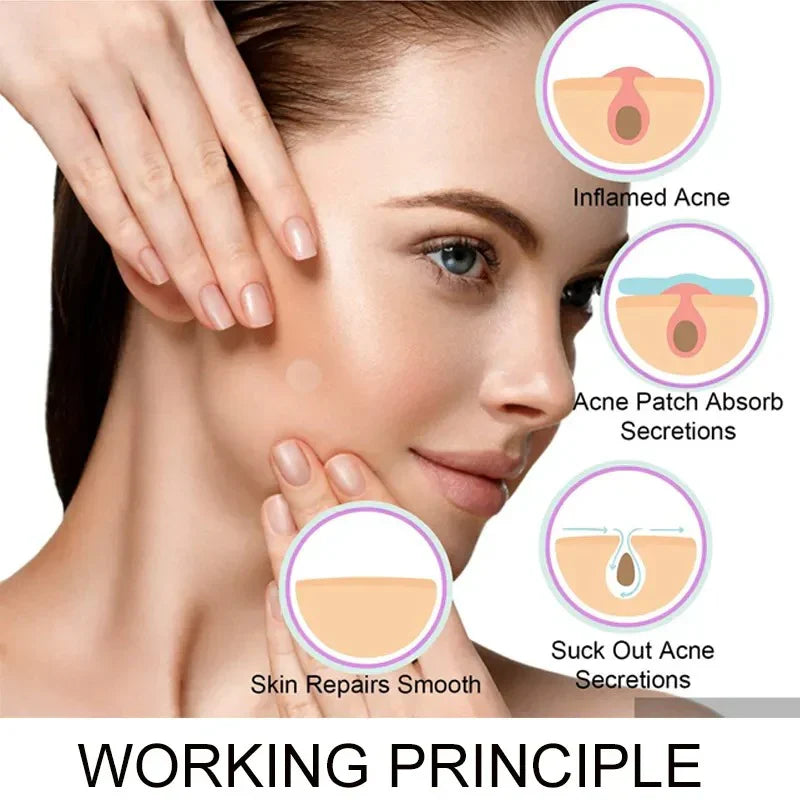 Face Acne Pimple Patch - Pack of 36 | Pimple Healing & Spot Clearing Patch | Invisible, Hydrocolloid Skin Treatment for All Skin Types